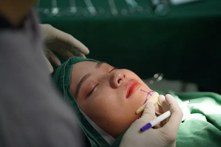 Phẫu thuật độn cằm giải pháp cho mặt thon gọn vline