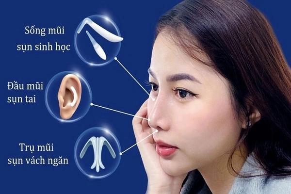 Nâng mũi bao nhiêu tiền? Cập nhật bảng giá mới nhất 2025